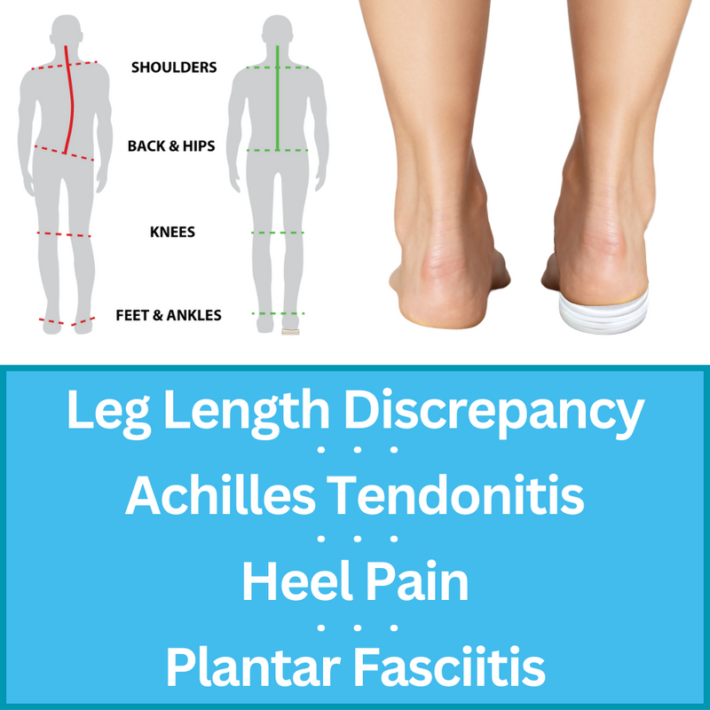 Soul Insole | Best Running Insoles | Plantar Fasciitis X