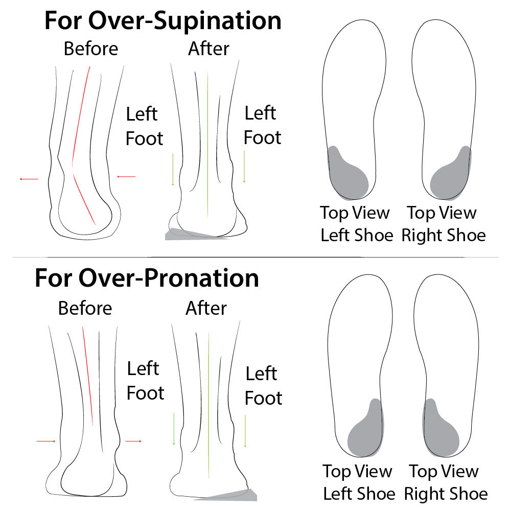 Heel Wedge  (Re-Usable, Adhesive)