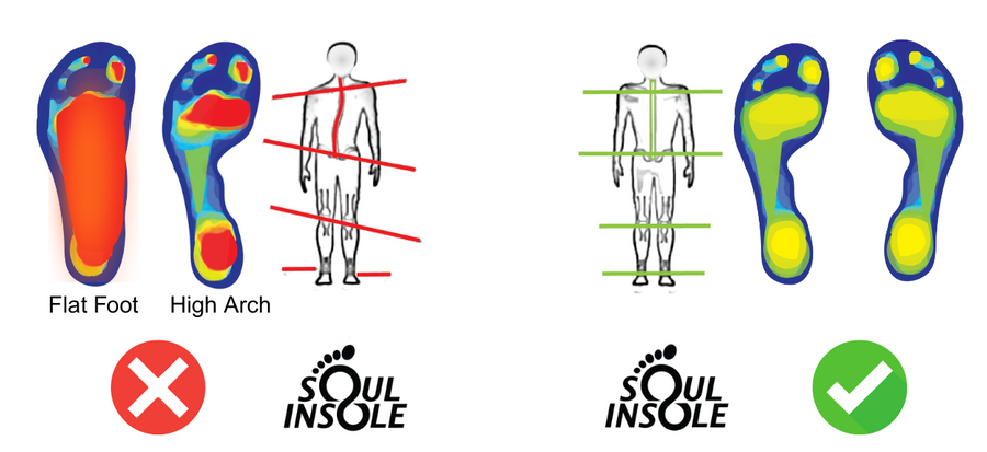 Soul Insole | Best Running Insoles | Plantar Fasciitis X